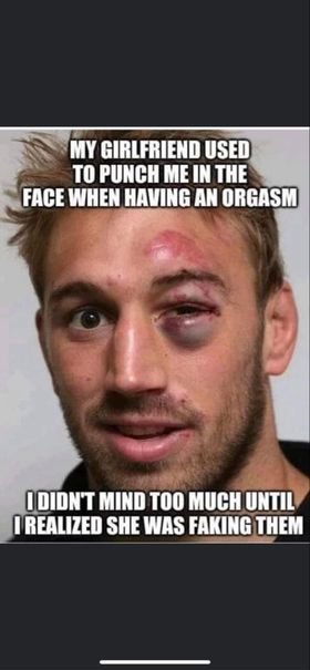 black eye.jpg