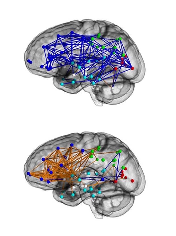brains-pav2.jpg