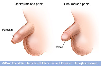 pr7_circumcision.jpg
