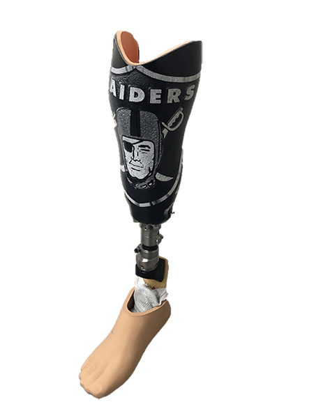 raider-prosthetic-leg.png