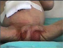 scrotum.jpg
