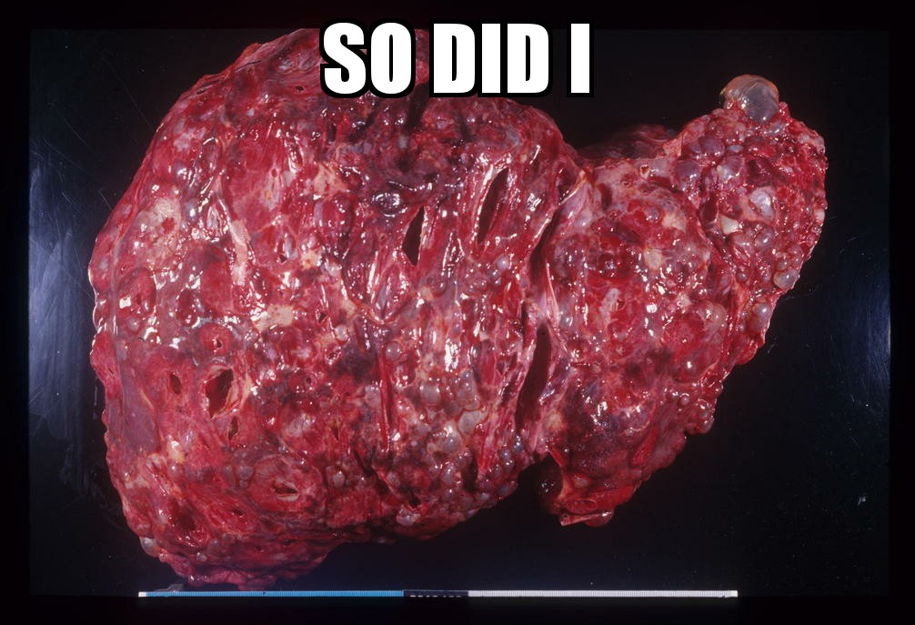 ZomboMeme 27092018203328.jpg