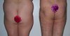 nophsp.jpg